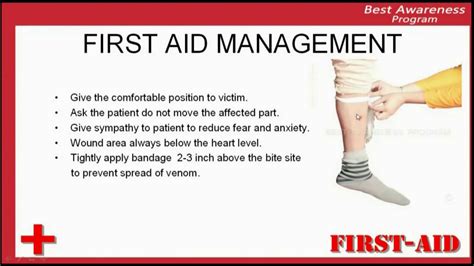 What Are The First Aid Procedures For A Snake Bite Snake Poin