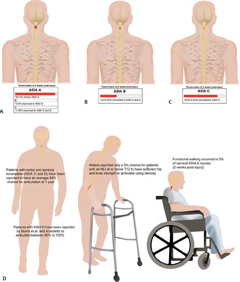 Spontaneous Recovery Patterns And Prognoses After Spinal Cord Injury