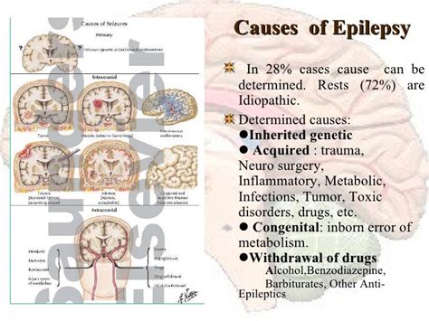 Epilepsy An Overview