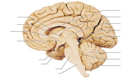 Lab 5 Midsagittal Section Of The Brain Cadaver Diagram Quizlet