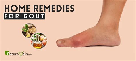 7 Best Home Remedies For Gout To Prevent Arthritis