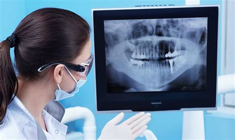 Dental Radiographs X Rays Vc Dental
