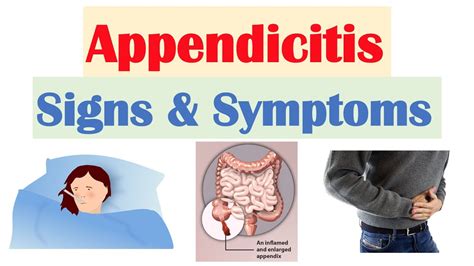 Appendicitis Signs Symptoms Why They Occur Youtube