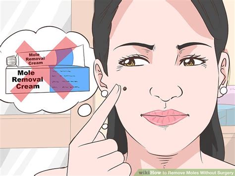 How To Remove Moles Without Surgery With Pictures Wikihow