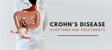 Crohn S Disease Symptoms And Treatments Explained Dr Deetlefs