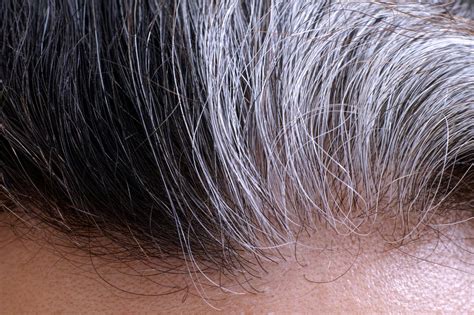 Its True Stress Does Turn Hair Gray And Its Reversible