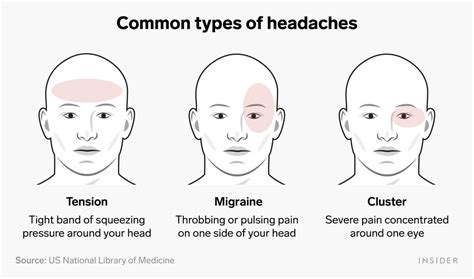 Headache Chart Types By Symptoms Location And Causes 45 Off