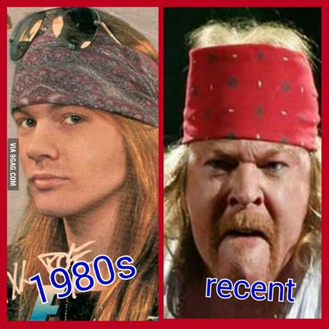 Axl Rose Guns N Roses Then And Now Gag