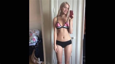 Swedish Teen Agnes Hedengard Shows Bum Deemed Too Big For Modelling