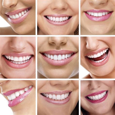 Smile Design Aesthetic Advantage Aesthetic Dental Education