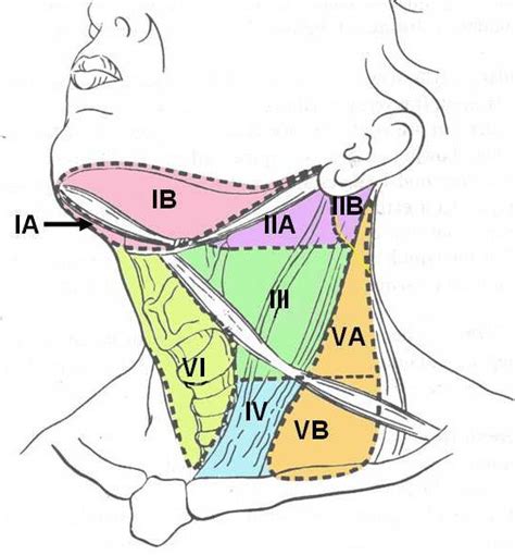 Diagrammatic Representation Of The Neck Showing Various Nodal Levels