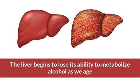 Alcohol The Liver And Aging Central Kasoa Clinic
