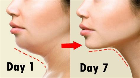 remove double chin in 1 week with simple steps सिर्फ 7 दिन में double chin हो जायेगा गायब