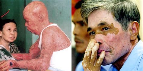 Dioxins accumulate in the body to cause cancers. THE VA MOTTO: "DELAY AND DENY, UNTIL THEY ALL DIE" - THE ...