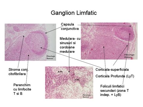 Ganglion Limfatic Capsula Conjunctiva Medulara Cu Sinusuri Si Cordoane