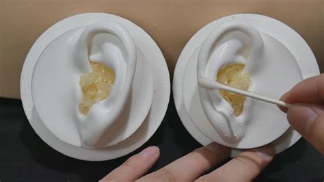 Asmr Your Ears Are Full Of Earwax 7 Pop Rocks Popping Sound Ear