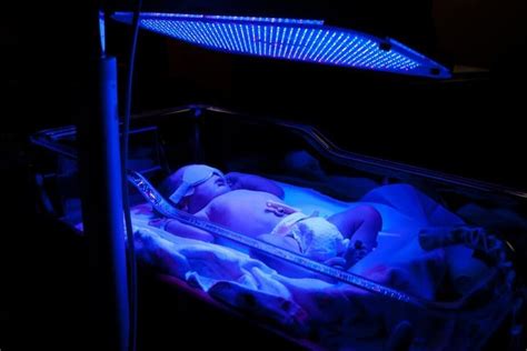 Types Of Phototherapy Lights For Jaundice Shelly Lighting