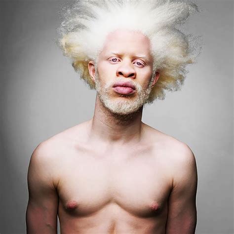 58 Albino People Wholl Mesmerize You With Their Otherworldly Beauty