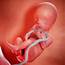Pregnancy Week 20 Fetal Development Ultrasound Sleep Tips 
