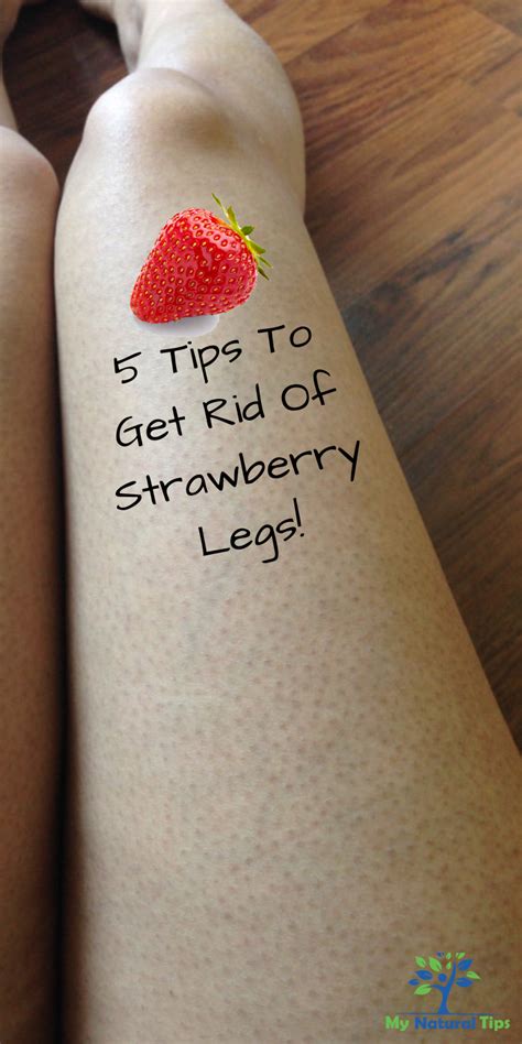 5 Tips To Get Rid Of Strawberry Legs Strawberry Legs Skin Care