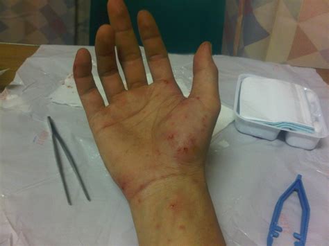 The carpal tunnel is a narrow passageway on the palm side of your wrist made up of bones and ligaments. SINGAPOREDREAM: Best hospital in Singapore