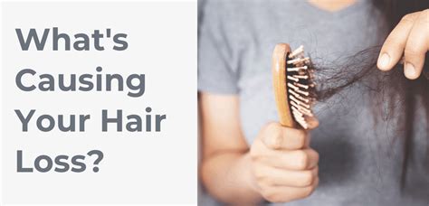 Whats Causing Your Hair Loss Mississauga And Oakville Chiropractor