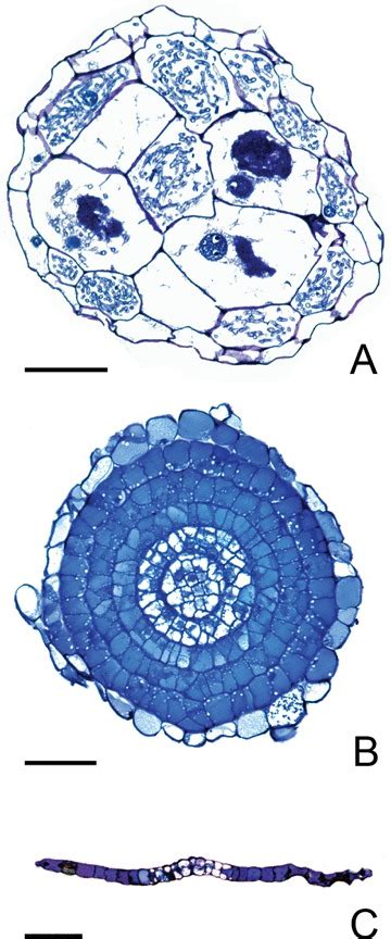 Light Microscopic Images Of Transverse Sections Through Different Plant