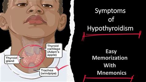 Hypothyroidism Symptoms With Mnemoniceasy To Memorize Hashimotos