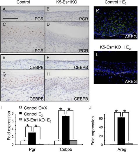 Epithelial Estrogen Receptor 1 Intrinsically Mediates Squamous Differentiation In The Mouse