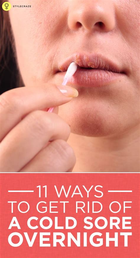 The feeling of cold is an awful one. How To Get Rid Of Cold Sores - 20 Home Remedies And Other ...