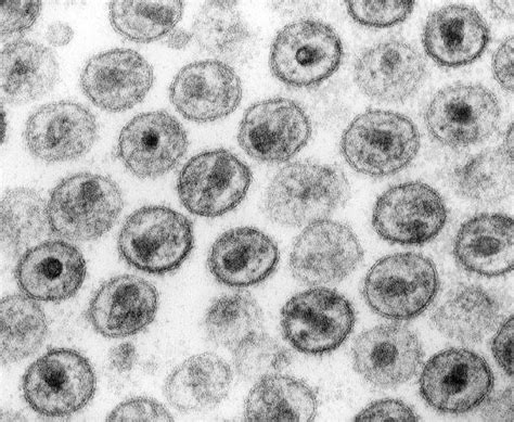 Langerhans Cells Affect Hiv Transmission Immunopaedia