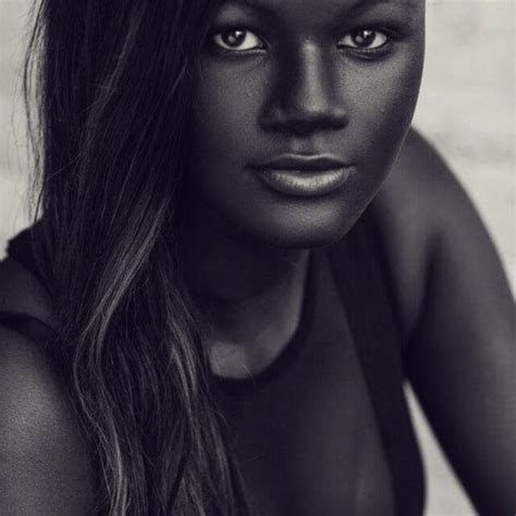 Teen Bullied Extremely Dark Skin Color Becomes Model Takes Internet Storm 5 Women Daily Magazine