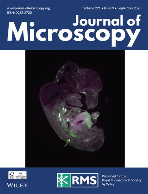 Journal Of Microscopy Wiley Online Library
