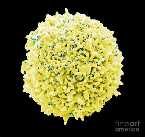 T Cell Infected With Hiv Photograph By Steve Gschmeissnerscience Photo