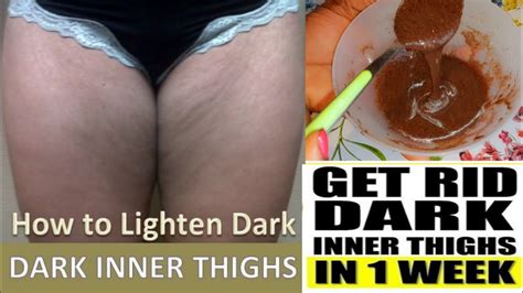 how to lighten dark inner thighs fast and naturally youtube