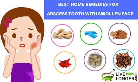 Best 10 Home Remedies For Abscess Tooth With Swollen Face Abscess