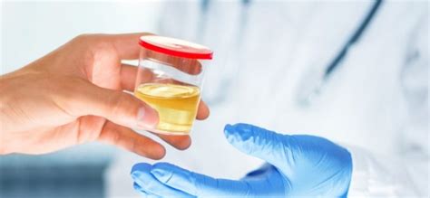 How To Use Synthetic Urine For A Drug Test Medicalopedia
