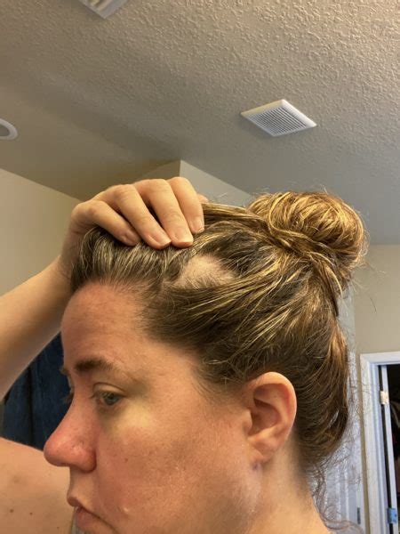 It is important to note that the regular use of hair. Has Your Doctor Misdiagnosed Cancer - How To Regain Your ...
