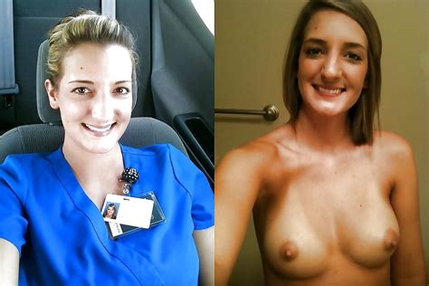Before And After Great Tits Pics Xhamster