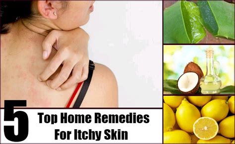 Top 5 Home Remedies For Itchy Skin Natural Cure And Herbal