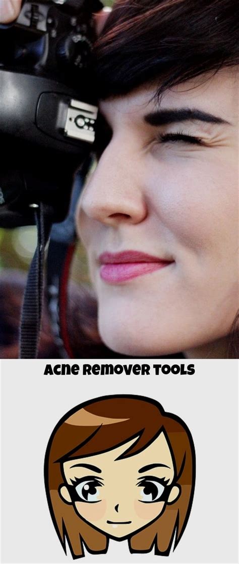 Top picks related reviews newsletter. Acne Remover Tools 656 20180907022633 64 Acne Youtube Girl