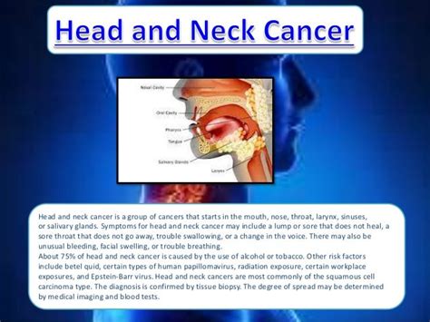 Signs And Symptoms Of Head And Neck Cancer