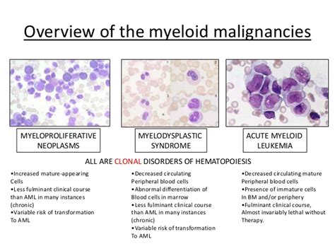 Myeloid Malignancy Overview