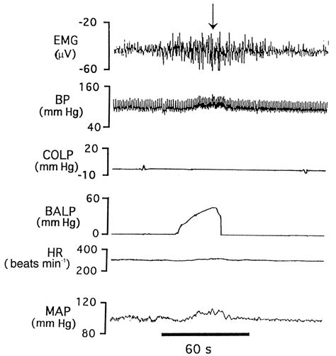 Measurements Of The Electromyogram Emg Arterial Blood Pressure Bp