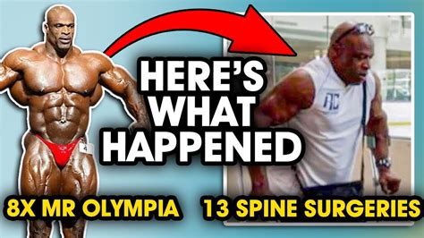 Ronnie Coleman Mr 8x Olympia To 13 Spine Sugeries Heres What