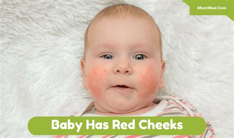 Your Baby Has Red Cheeks On One Side Of Face Or Both Are You Wondering