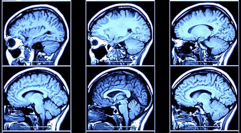 Criminal Minds Are Different From Yours Brain Scans Reveal Live Science