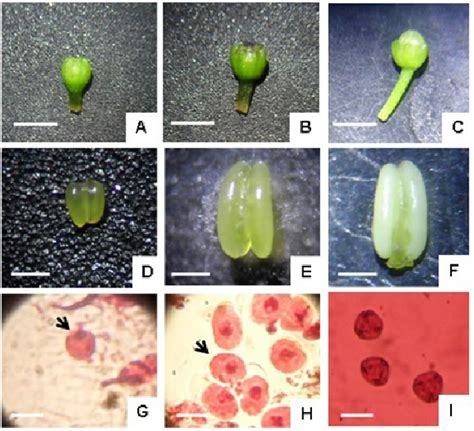 Relationship Between Flower Bud Morphologicaltraitsand Microspore
