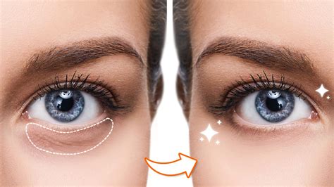 How To Remove Dark Circles From Photos Easily In Perfect