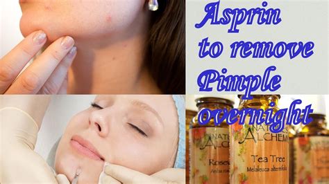 remove pimple overnight remove pimple instantly with aspirin 100 success 3 easy steps
